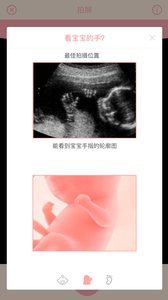 胎儿相机  v1.1.1图3